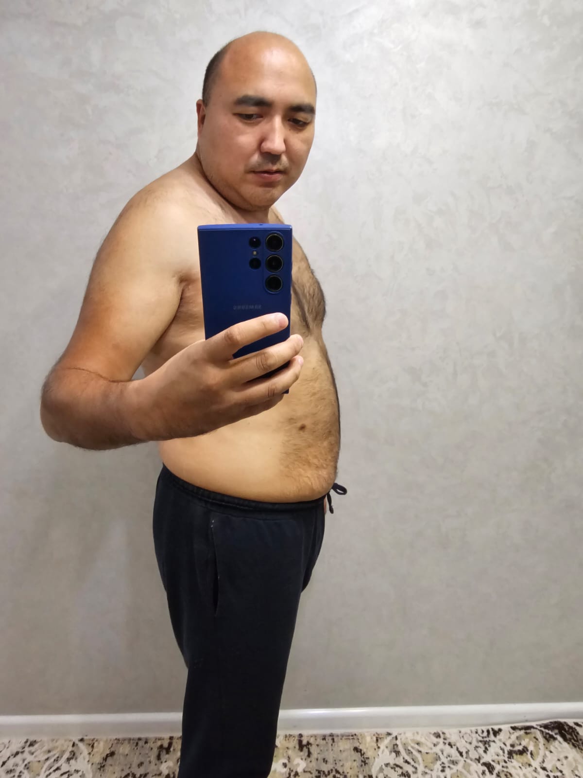 Жизнь после операции